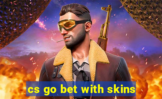 cs go bet with skins