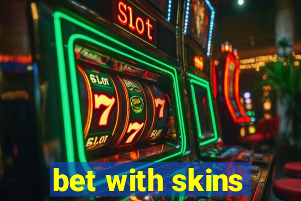 bet with skins