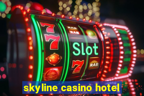 skyline casino hotel